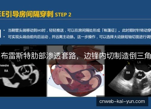 布雷斯特肋部渗透套路，边锋内切制造倒三角